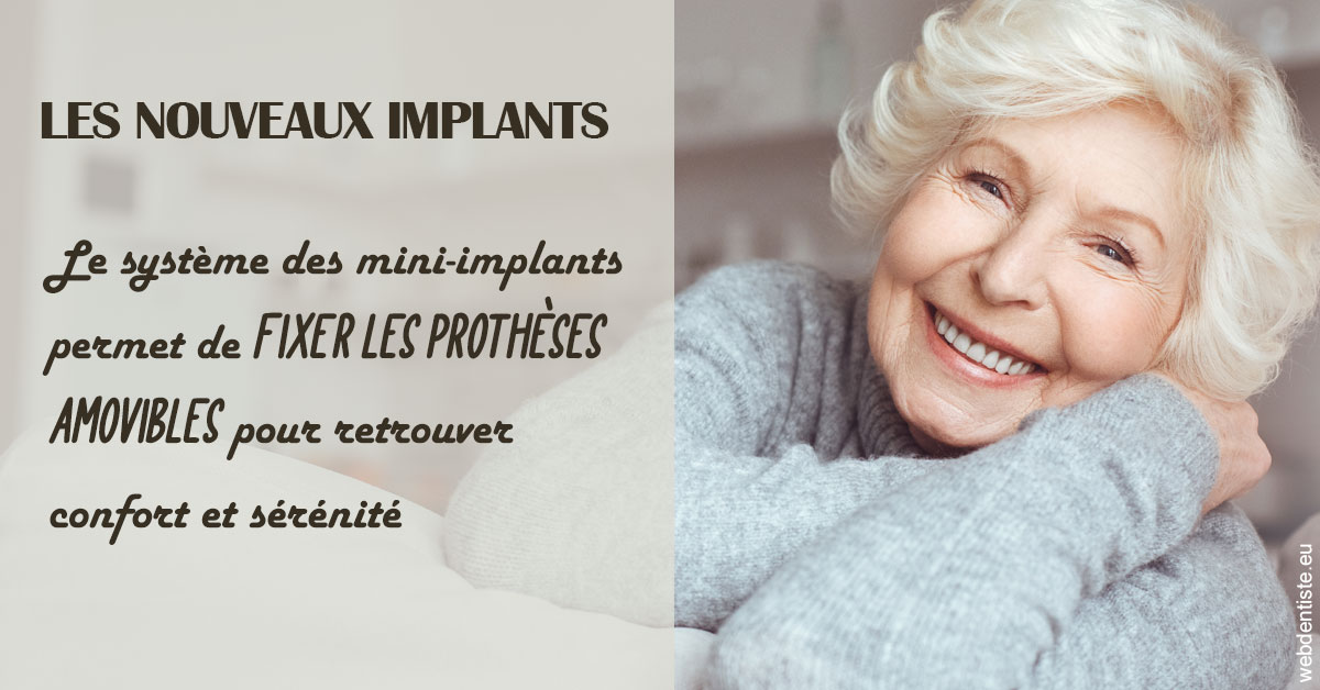https://selarl-stephane-palmer.chirurgiens-dentistes.fr/Les nouveaux implants 1