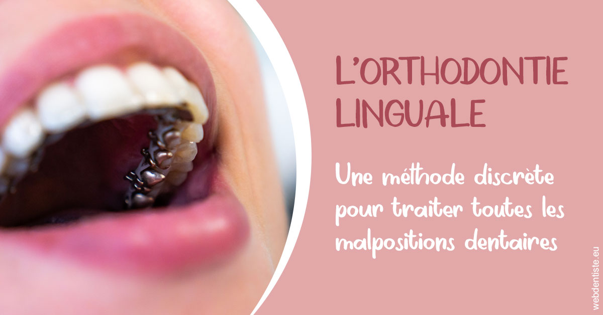 https://selarl-stephane-palmer.chirurgiens-dentistes.fr/L'orthodontie linguale 2