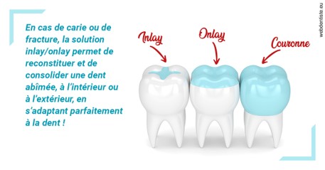 https://selarl-stephane-palmer.chirurgiens-dentistes.fr/L'INLAY ou l'ONLAY