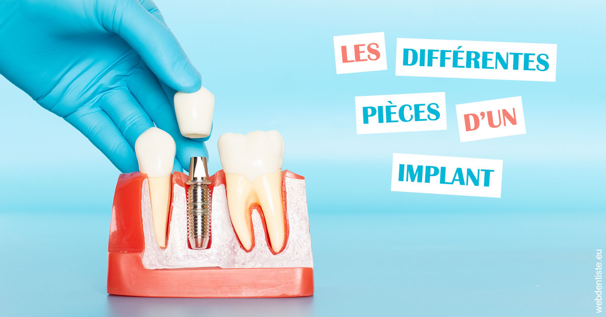 https://selarl-stephane-palmer.chirurgiens-dentistes.fr/Les différentes pièces d’un implant 2