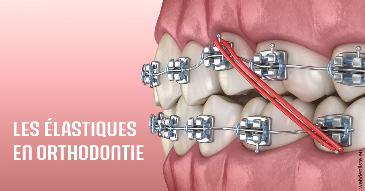 https://selarl-stephane-palmer.chirurgiens-dentistes.fr/Elastiques orthodontie 2