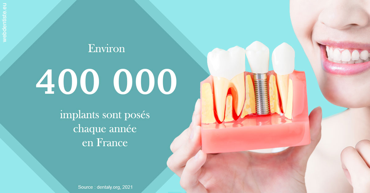 https://selarl-stephane-palmer.chirurgiens-dentistes.fr/Pose d'implants en France 2